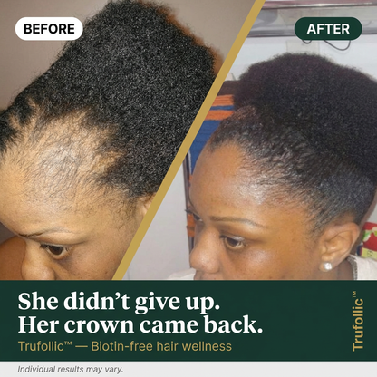 Trufollic  Hair Wellness Formula